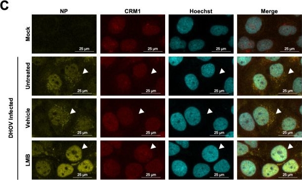 Fig.1.C showing Immunocytochemistry-immunofluorescence from the publication: Involvement of a tick-borne orthomyxovirus matrix protein in vRNP nuclear export.
