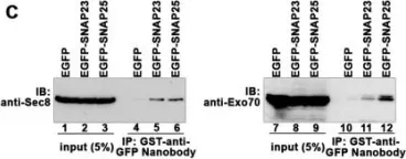 Fig.1.C showing Western Blotting in a Homo sapiens (Human) sample from the publication: SNAP23/25 and VAMP2 mediate exocytic event of transferrin receptor-containing recycling vesicles.