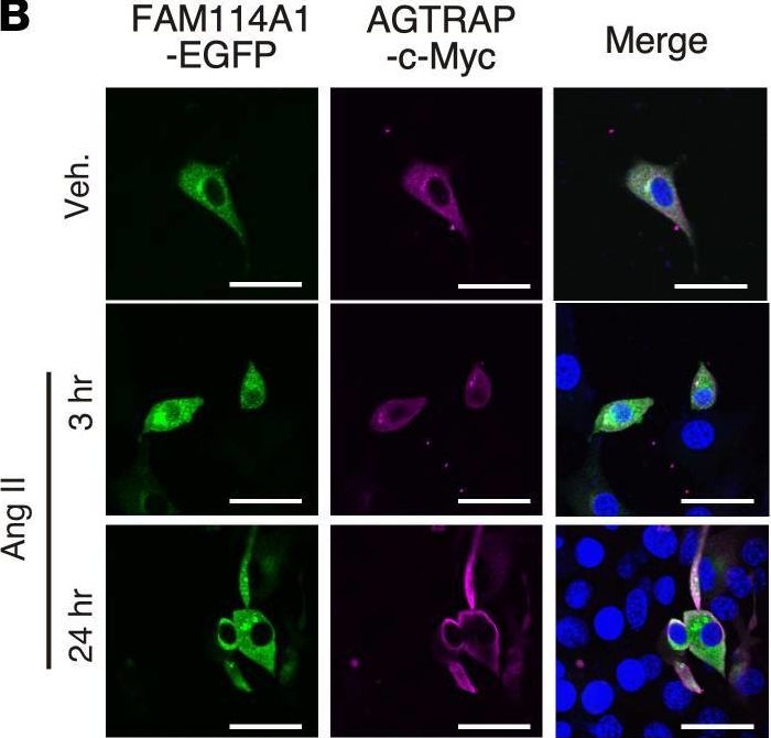 Fig.6.B showing Immunocytochemistry-immunofluorescence in a Mus musculus (House mouse) sample from the publication: FAM114A1 influences cardiac pathological remodeling by regulating angiotensin II signaling.