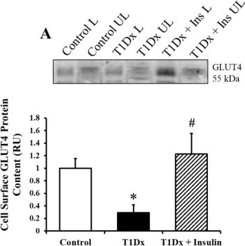 Fig.5.A showing Western Blotting in a Mus musculus (House mouse) sample from the publication: Diabetes Causes Significant Alterations in Pulmonary Glucose Transporter Expression.