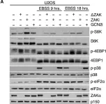 Fig.2.A showing Western Blotting from the publication: Ribosome stalling is a signal for metabolic regulation by the ribotoxic stress response.
