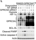Fig.4.L showing Western Blotting from the publication: Cancer cell adaptation to hypoxia involves a HIF-GPRC5A-YAP axis.