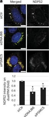 Fig.5.A showing Immunocytochemistry-immunofluorescence from the publication: A chaperone-proteasome-based fragmentation machinery is essential for aggrephagy.