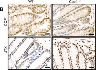 Fig.7.B showing Immunohistochemistry in a Mus musculus (House mouse) sample from the publication: CUL4B-DDB1-COP1-mediated UTX downregulation promotes colorectal cancer progression.