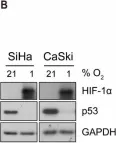 Fig.1.B showing Western Blotting from the publication: p53 Is Regulated in a Biphasic Manner in Hypoxic Human Papillomavirus Type 16 (HPV16)-Positive Cervical Cancer Cells.