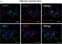 Fig.6.A showing Immunohistochemistry in a Mus musculus (House mouse) sample from the publication: Ninjurin1 Deletion in NG2-Positive Pericytes Prevents Microvessel Maturation and Delays Wound Healing.