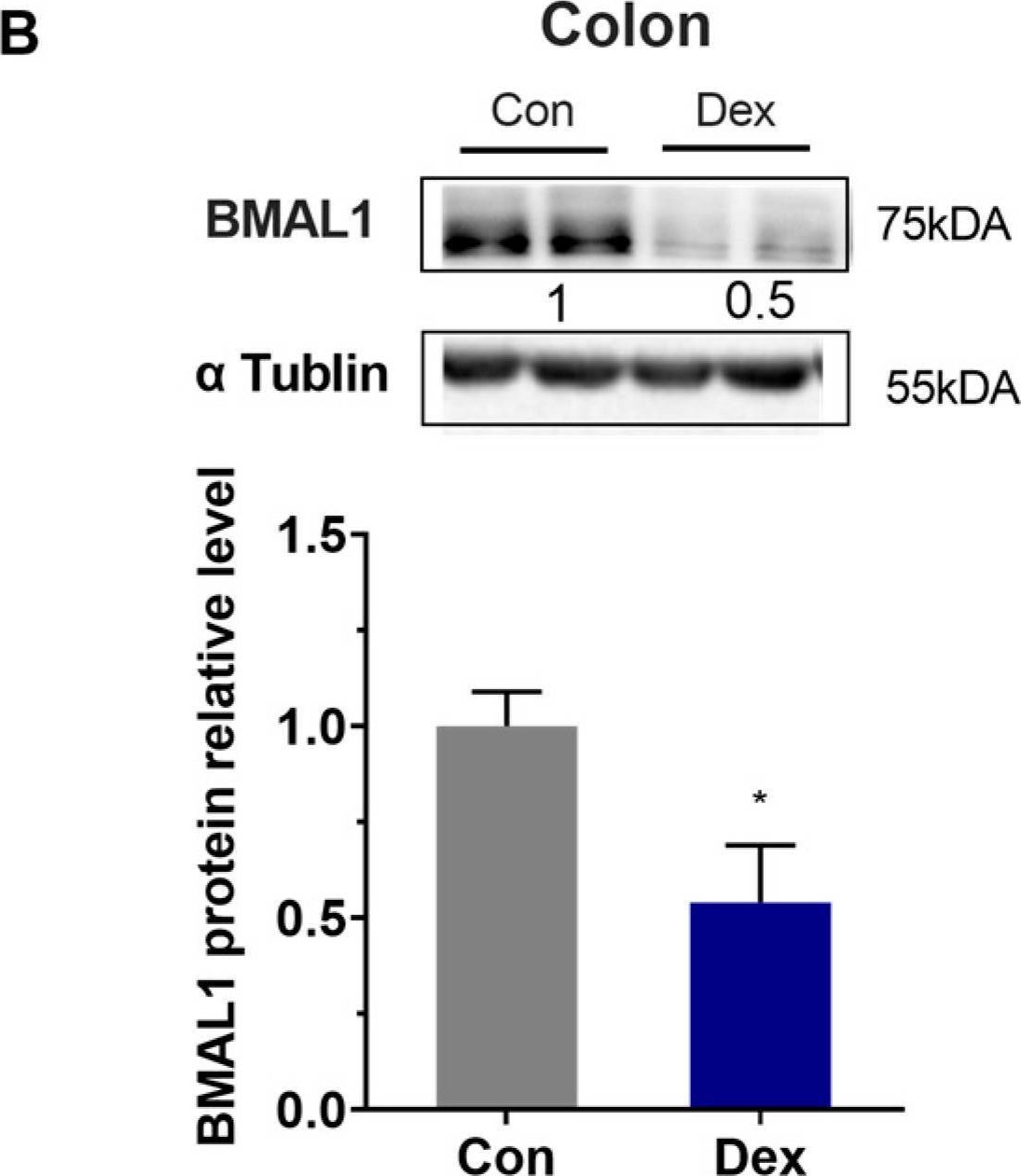 Fig.5.B showing Western Blotting in a Capra aegagrus hircus (Goat) sample from the publication: Chronic Dexamethasone Disturbs the Circadian Rhythm of Melatonin and Clock Genes in Goats.