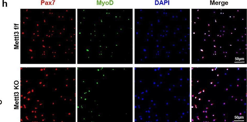 Fig.3.H showing Immunocytochemistry-immunofluorescence in a Mus musculus (House mouse) sample from the publication: Exercise promotes skeletal muscle growth in adolescents via modulating Mettl3-mediated m6A methylation of MyoD in muscle satellite cells.