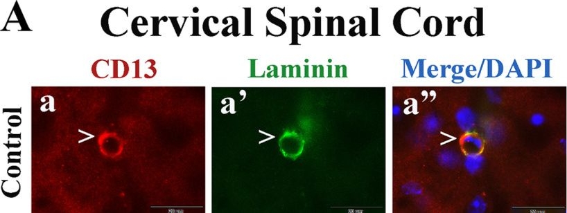Fig.2.A showing Immunohistochemistry-immunofluorescence in a Mus musculus (House mouse) sample from the publication: Beneficial Effects of Transplanted Human Bone Marrow Endothelial Progenitors on Functional and Cellular Components of Blood-Spinal Cord Barrier in ALS Mice.