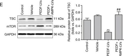 Fig.5.E showing Western Blotting from the publication: PEDF inhibits non‑small cell lung cancer proliferation by suppressing autophagy through downregulation of AMPK‑ULK1 signaling.