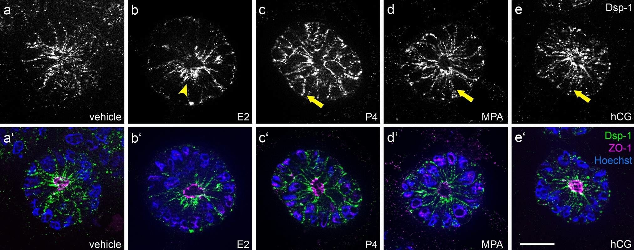 Steroid hormones and human choriogonadotropin influence the distribution of alpha6-integrin and desmoplakin 1 in gland-like endometrial epithelial spheroids.