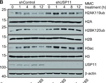 Fig.4.B showing Western Blotting in a Homo sapiens (Human) sample from the publication: USP11 acts as a histone deubiquitinase functioning in chromatin reorganization during DNA repair.