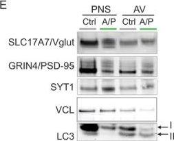 Fig.7.E showing Western Blotting in a Mus musculus (House mouse) sample from the publication: Adult-onset deactivation of autophagy leads to loss of synapse homeostasis and cognitive impairment, with implications for alzheimer disease.
