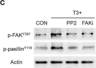 Fig.3.C showing Western Blotting from the publication: Molecular Actions of Thyroid Hormone on Breast Cancer Cell Migration and Invasion via Cortactin/N-WASP.