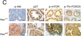 Fig.5.C showing Immunohistochemistry in a Mus musculus (House mouse) sample from the publication: Pten dose dictates cancer progression in the prostate.