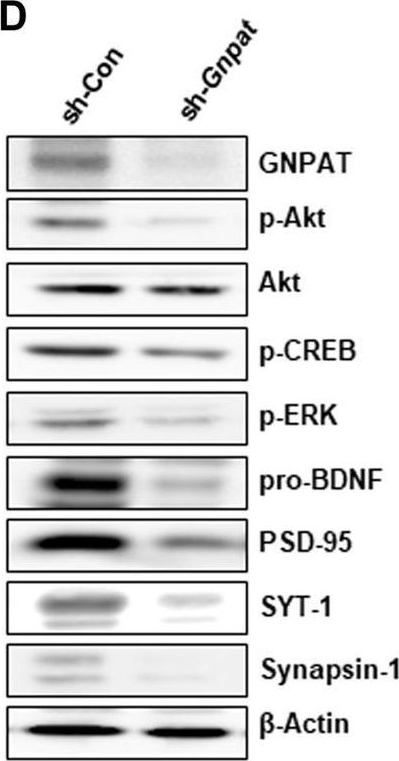 Fig.2.D showing Western Blotting from the publication: Plasmalogens, the Vinyl Ether-Linked Glycerophospholipids, Enhance Learning and Memory by Regulating Brain-Derived Neurotrophic Factor.