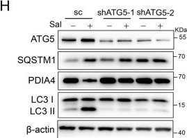 Fig.2.H showing Western Blotting from the publication: PDIA4 confers resistance to ferroptosis via induction of ATF4/SLC7A11 in renal cell carcinoma.