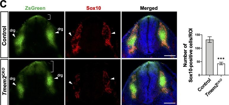 Fig.4.C showing Immunohistochemistry-immunofluorescence from the publication: The cell surface hyaluronidase TMEM2 plays an essential role in mouse neural crest cell development and survival.