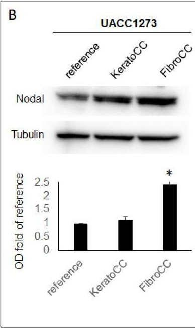 Fig.3.B showing Western Blotting in a Homo sapiens (Human) sample from the publication: Normal Skin Cells Increase Aggressiveness of Cutaneous Melanoma by Promoting Epithelial-to-Mesenchymal Transition via Nodal and Wnt Activity.