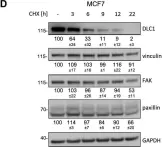 Fig.1.D showing Western Blotting in a Homo sapiens (Human) sample from the publication: Proteasomal turnover of the RhoGAP tumor suppressor DLC1 is regulated by HECTD1 and USP7.