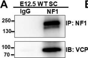 Fig.1.A showing Western Blotting in a Mus musculus (House mouse) sample from the publication: Valosin-Containing Protein Contributes to Plexiform Neurofibroma Formation and Represents a Novel Therapeutic Target.