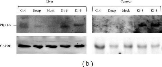 Fig.1.B showing Western Blotting in a Mus musculus (House mouse) sample from the publication: Plasmid transfer of plasminogen K1-5 reduces subcutaneous hepatoma growth by affecting inflammatory factors.