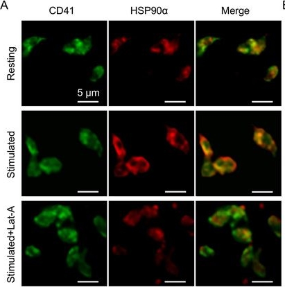 Fig.2.A showing Immunocytochemistry-immunofluorescence from the publication: Activated Platelet-Released Heat Shock Protein 90α Triggers Autophagy-Dependent Neutrophil Extracellular Trap Formation and Amplifies Sepsis.