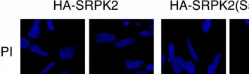 Fig.3.A showing Western Blotting in a Homo sapiens (Human) sample from the publication: Paraquat modulates alternative pre-mRNA splicing by modifying the intracellular distribution of SRPK2.