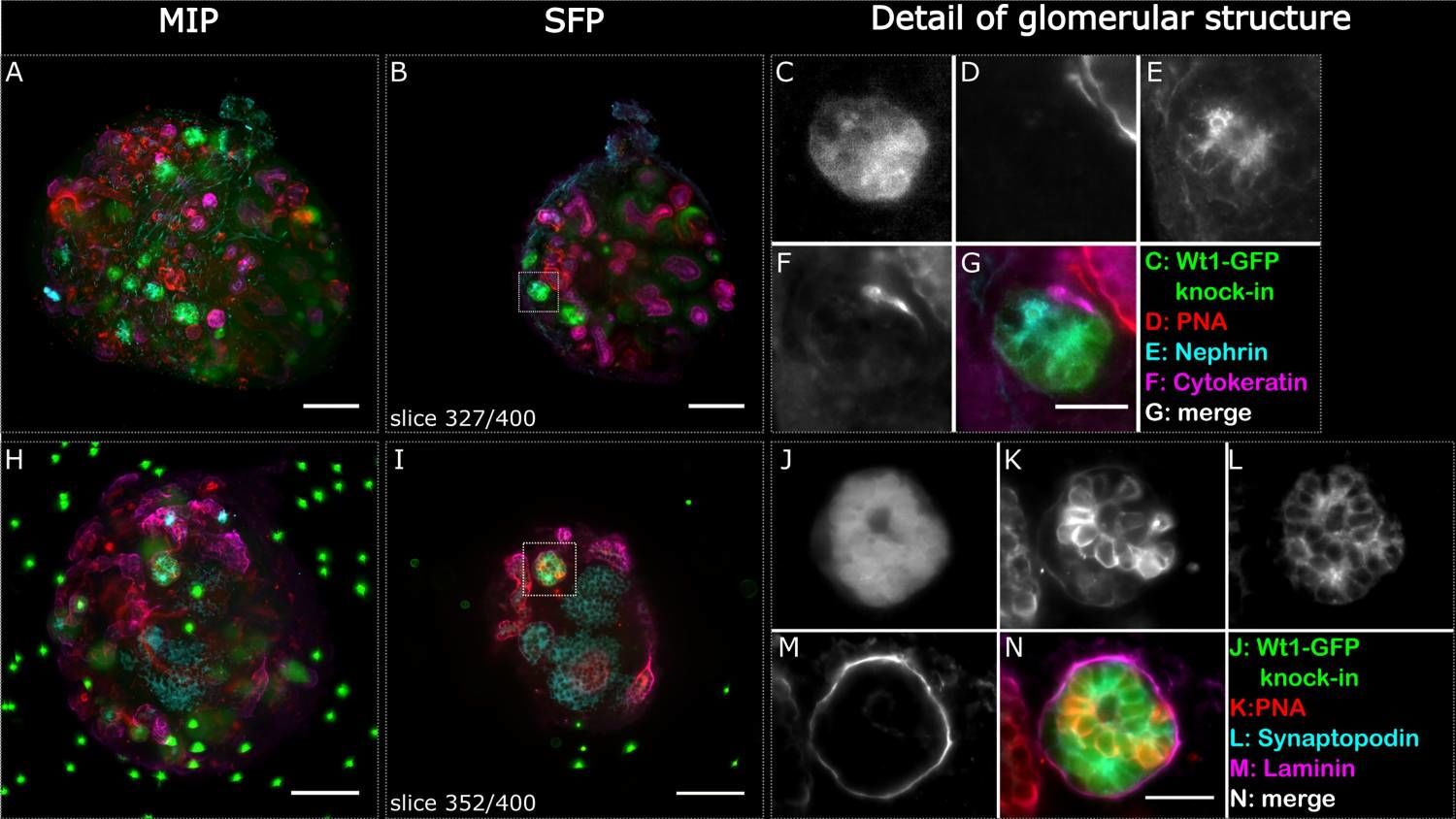 Ex vivo live cell tracking in kidney organoids using light sheet fluorescence microscopy.