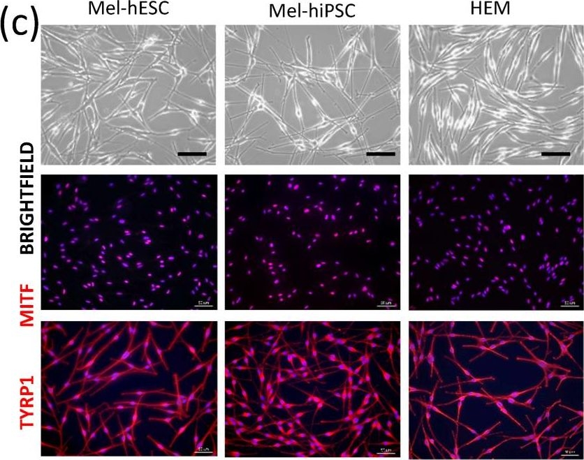 Fig.1.C showing Immunocytochemistry-immunofluorescence in a Homo sapiens (Human) sample from the publication: Generating Functional and Highly Proliferative Melanocytes Derived from Human Pluripotent Stem Cells: A Promising Tool for Biotherapeutic Approaches to Treat Skin Pigmentation Disorders.