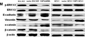 Fig.3.M showing Western Blotting in a Homo sapiens (Human) sample from the publication: YAP1 enhances cell proliferation, migration, and invasion of gastric cancer in vitro and in vivo.