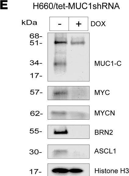 Fig.6.E showing Western Blotting in a Homo sapiens (Human) sample from the publication: MUC1-C dependence in treatment-resistant prostate cancer uncovers a target for antibody-drug conjugate therapy.