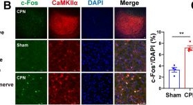 Fig.1.B showing Immunocytochemistry-immunofluorescence in a Mus musculus (House mouse) sample from the publication: A Novel Long-range Excitatory Neural Circuit from the Magnocellular Red Nucleus to Spinal Dorsal Horn Facilitates Neuropathic Pain-like Behaviors in Male Mice.