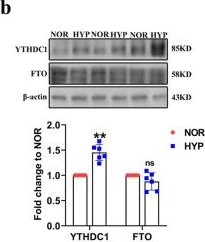 Fig.6.B showing Western Blotting from the publication: LncRNA FENDRR with m6A RNA methylation regulates hypoxia-induced pulmonary artery endothelial cell pyroptosis by mediating DRP1 DNA methylation.