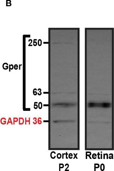 Fig.1.B showing Western Blotting in a Mus musculus (House mouse) sample from the publication: G protein-coupled estrogen receptor expression in postnatal developing mouse retina.