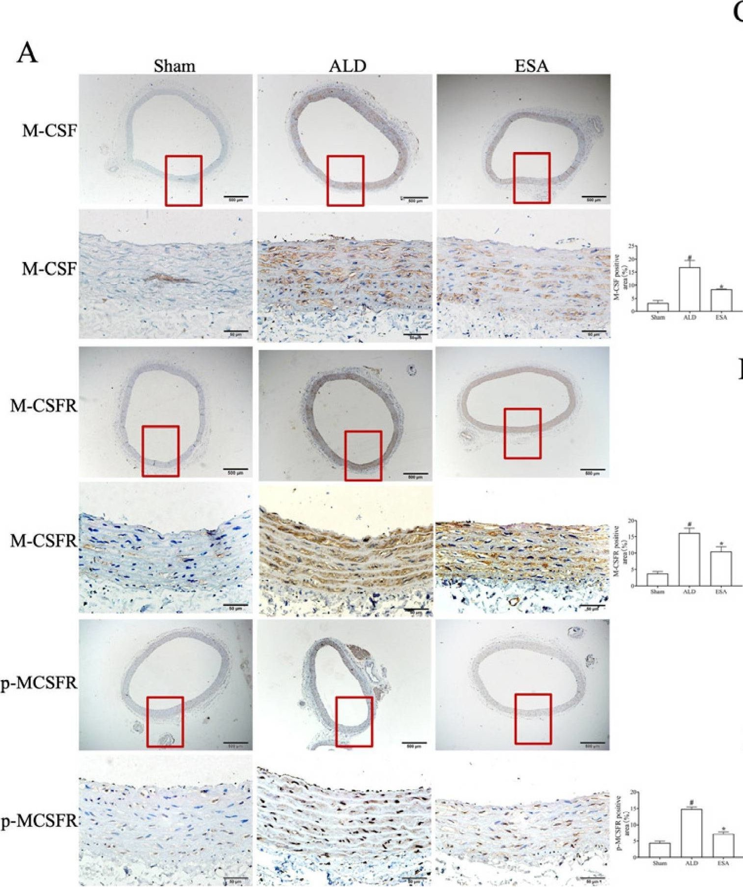 Fig.6.A showing Immunohistochemistry in a Rattus norvegicus (Rat) sample from the publication: Aldosterone-Induced Transformation of Vascular Smooth Muscle Cells into Macrophage-like Cells Participates in Inflammatory Vascular Lesions.