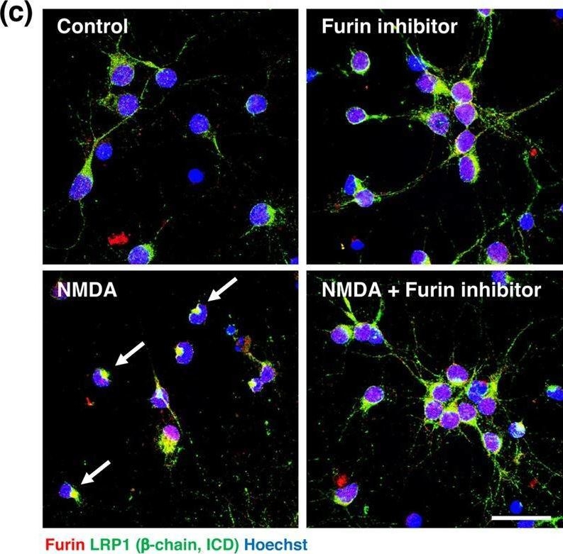 Fig.8.C showing Immunocytochemistry-immunofluorescence from the publication: Furin-mediated cleavage of LRP1 and increase in ICD of LRP1 after cerebral ischemia and after exposure of cultured neurons to NMDA.