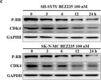Fig.1.C showing Western Blotting in a Homo sapiens (Human) sample from the publication: Autophagic degradation of CDK4 is responsible for G0/G1 cell cycle arrest in NVP-BEZ235-treated neuroblastoma.