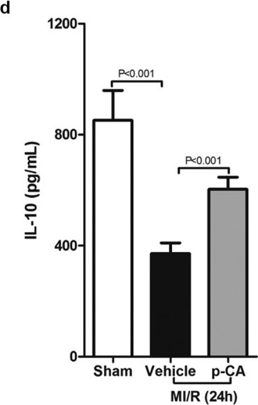 Fig.5.D showing Enzyme-linked immunosorbent assay from the publication: p-Coumaric acid regulates macrophage polarization in myocardial ischemia/reperfusion by promoting the expression of indoleamine 2, 3-dioxygenase.