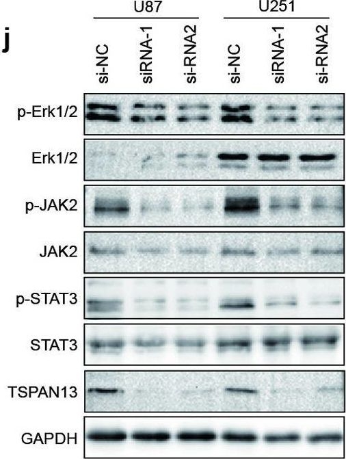 Fig.7.J showing Western Blotting in a Homo sapiens (Human) sample from the publication: Identification and validation of TSPAN13 as a novel temozolomide resistance-related gene prognostic biomarker in glioblastoma.