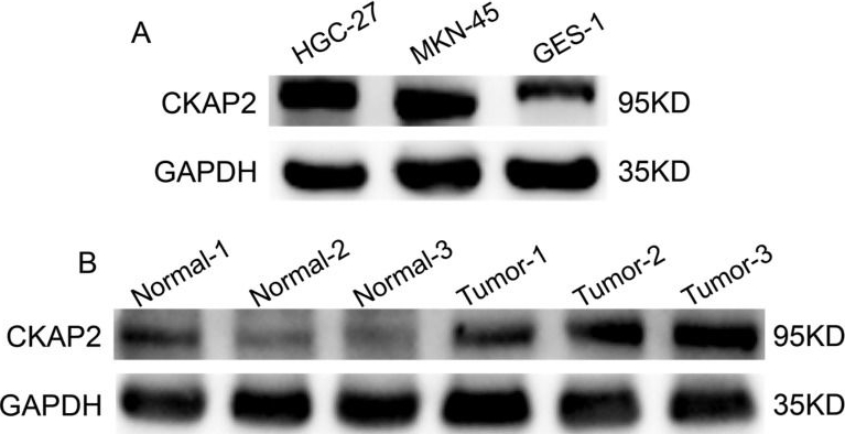 Fig.10.A showing Western Blotting in a Homo sapiens (Human) sample from the publication: Integrated Single-Cell Virtual Knockout and Machine Learning Analyses Reveal a Protective Role of CKAP2 in Gastric Cancer.