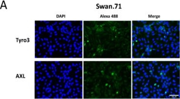 Fig.1.A showing Immunocytochemistry-immunofluorescence in a Chlorocebus sabaeus (Green monkey) sample from the publication: TGF-β1 Promotes Zika Virus Infection in Immortalized Human First-Trimester Trophoblasts via the Smad Pathway.