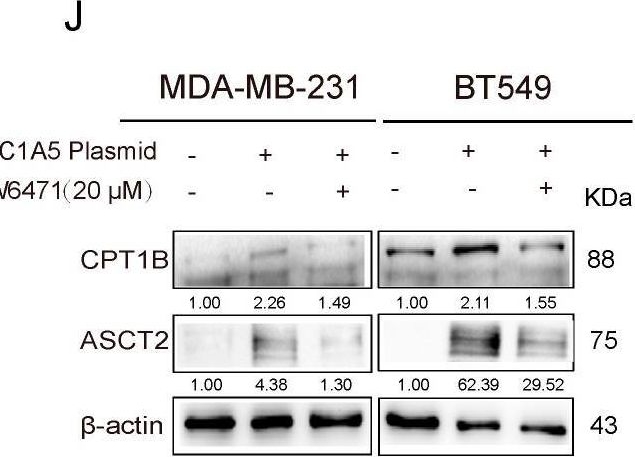 Fig.4.J showing Western Blotting from the publication: ASCT2 Regulates Fatty Acid Metabolism to Trigger Glutamine Addiction in Basal-like Breast Cancer.