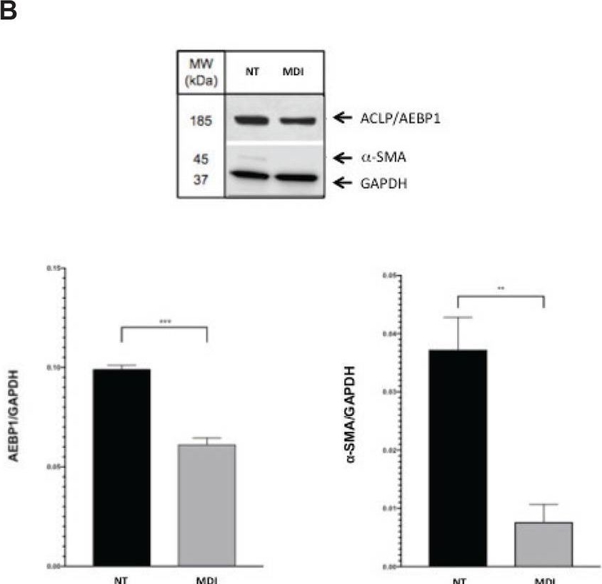 Fig.2.B showing Western Blotting in a Homo sapiens (Human) sample from the publication: AEBP1 expression increases with severity of fibrosis in NASH and is regulated by glucose, palmitate, and miR-372-3p.