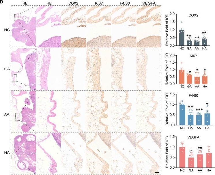 Fig.7.D showing Immunohistochemistry from the publication: Serum metabolic fingerprinting for diagnosis and therapeutic applications of ovarian endometriosis.