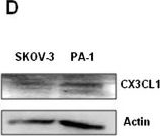 Fig.2.D showing Western Blotting from the publication: Fractalkine receptor is expressed in mature ovarian teratomas and required for epidermal lineage differentiation.