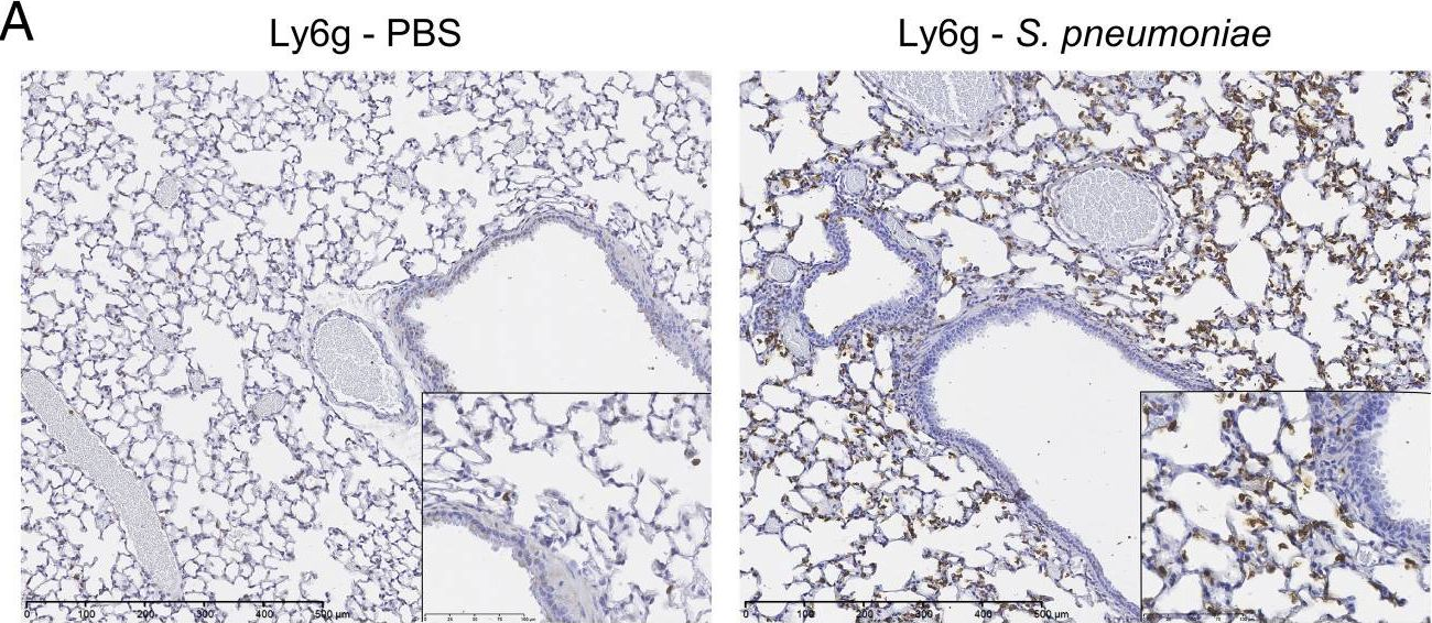 Fig.1.A showing Immunohistochemistry-paraffin in a Mus musculus (House mouse) sample from the publication: Regulation of neutrophilic inflammation by proteinase-activated receptor 1 during bacterial pulmonary infection.