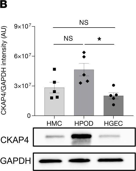 Fig.3.B showing Western Blotting in a Homo sapiens (Human) sample from the publication: Cytoskeleton-associated protein 4 affects podocyte cytoskeleton dynamics in diabetic kidney disease.