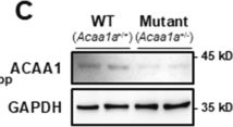 Fig.6.C showing Western Blotting from the publication: ACAA1 knockout increases the survival rate of KPC mice by activating autophagy.