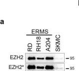 Fig.2.A showing Western Blotting from the publication: Pharmacological inhibition of EZH2 as a promising differentiation therapy in embryonal RMS.